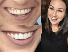 Load image into Gallery viewer, Snow® Teeth Whitening At-Home System [For SweatCoin]
