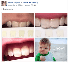 Load image into Gallery viewer, SNOW TEETH WHITENING™ SYSTÈME À DOMICILE [KIT TOUT-EN-UN]
