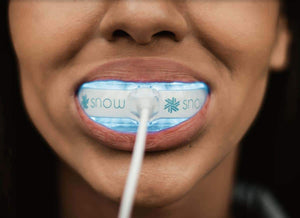 Snow® At-Home Teeth Whitening (ALL-IN-ONE KIT)