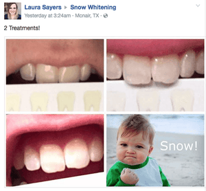 SNOW TEETH WHITENING™ ZAHNWEISS-SYSTEM FÜR ZUHAUSE [ALL-IN-ONE KIT]