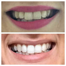 Load image into Gallery viewer, Snow® Teeth Whitening At-Home System [For SweatCoin]
